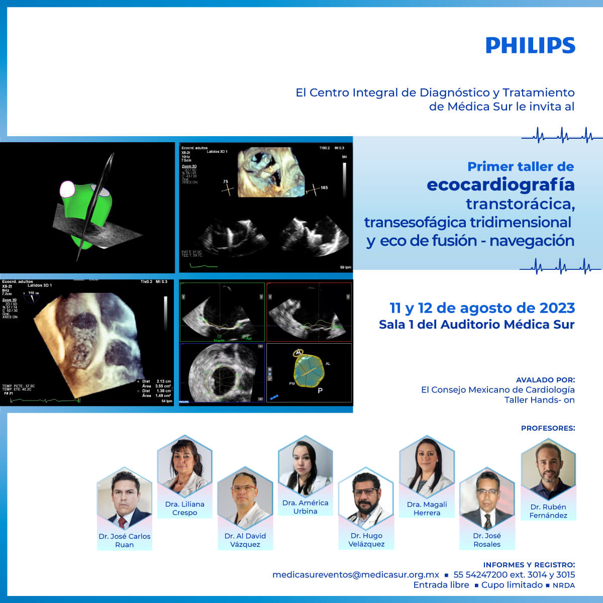 1� Taller de Ecocardiograf�a